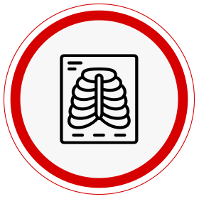 Radioterapia